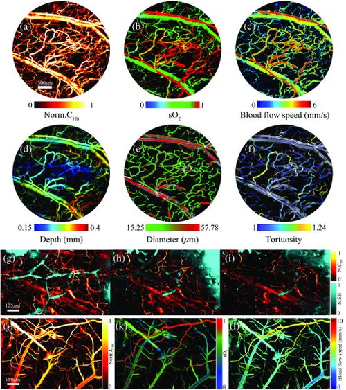 对象存储对比度_对比度
