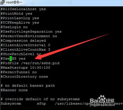 dns ssh代理服务器_开启UseDNS导致SSH连接缓慢怎么办？