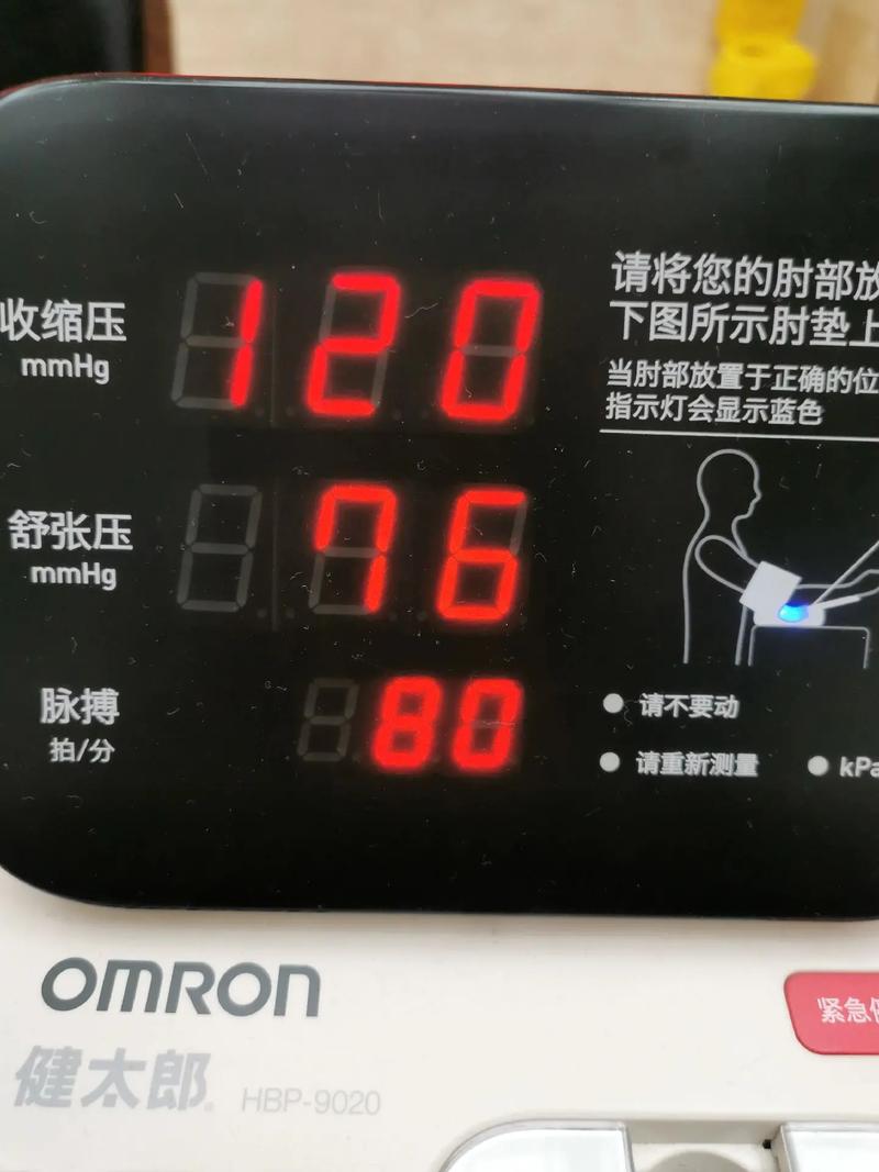 弹性负载均衡健康检查什么时候启动_健康检查什么时候启动？