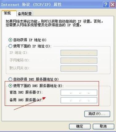 使用下面的DNS服务器是什么意思