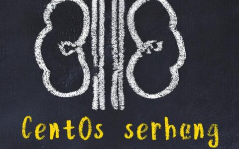 CentOS是镜像还是操作系统？两者到底有何区别？